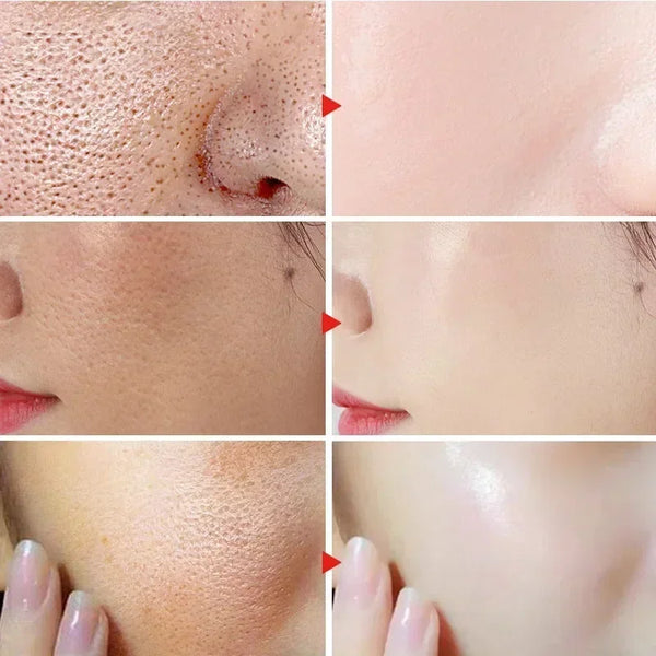 Lactobionic Acid Shrink Pores Facial Serum Firm Moisturizing Essence Liquid Repair Face Pores Beauty Skin Care Korean Cosmetics
